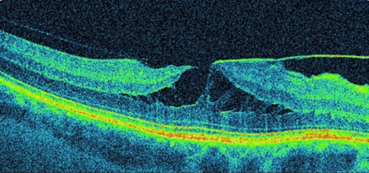 Picture - cross section of a human retina
